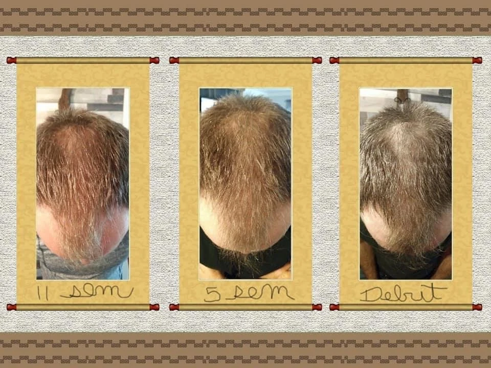 MEDAVITA - Duo Soins Anti-Chute Pour Hommes – Image 2